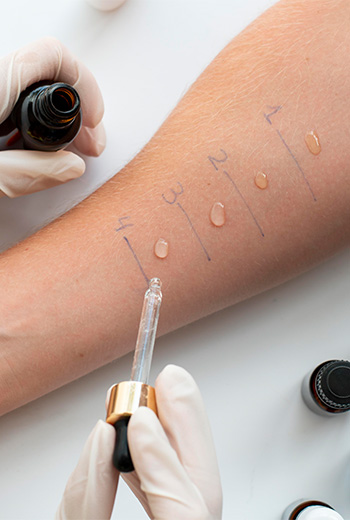 Drops being applied to a forearm during a skin test